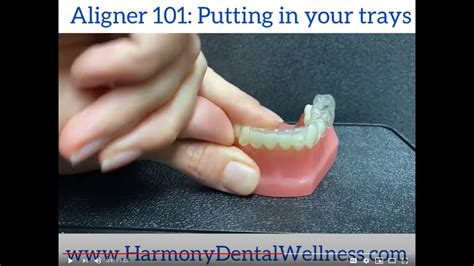 Putting In Your Invisalign Trays Aligner 101 Youtube