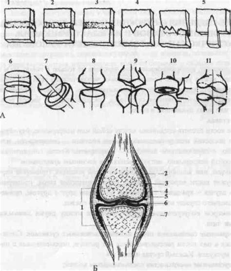 Пластика щеки.