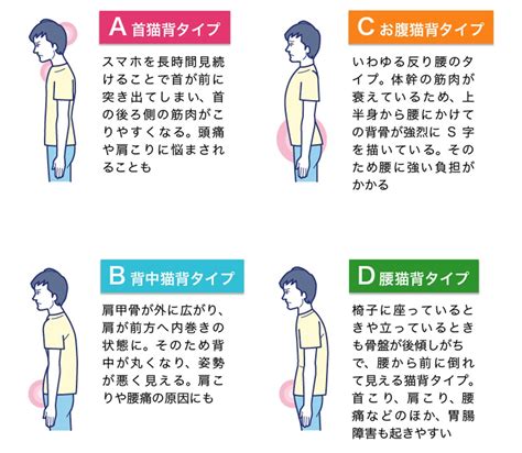 姿勢が悪いと「メンタル不調」の原因にも専門医が教える、10秒で可能な“セルフ診断”【イラストで解説】 ゴールドオンライン