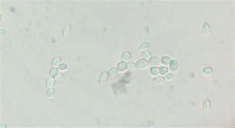 Candida glabrata - Morphology, Pathogenesis, Treatment, Prevention ...