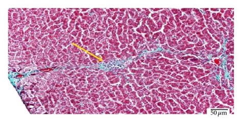 Light Photomicrograph Of Liver Sections Stained With Massons Trichrome Download Scientific