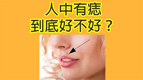 【面相学】人中有痣代表性欲强？如果有痣该不该点掉？ Youtube