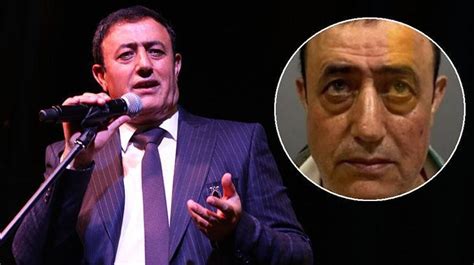 Mahmut Tuncer Estetik Yapt Rd Sen De Mi Br T S Magazin Haberleri