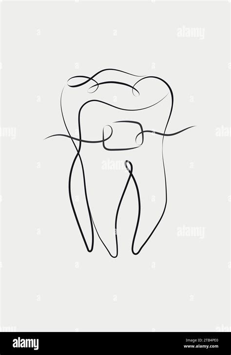 Tooth Braces Illustration In Linear Style Drawing On White Background