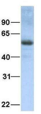 Txnip Antibody Nbp By Novus Part Of Bio Techne