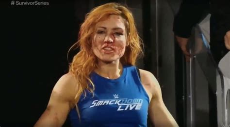 Becky Lynch Reportedly Pulled From Wwe Survivor Series