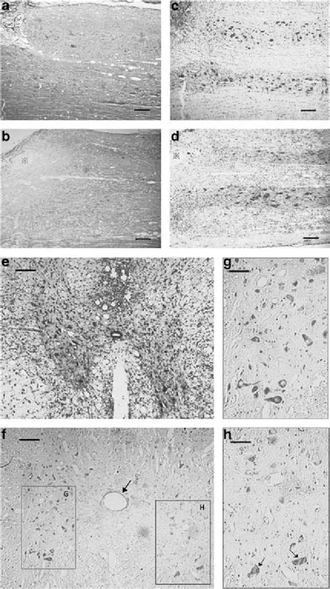 Images of myelin staining (a, b) and Nissl staining (c-h) at 21 days ...