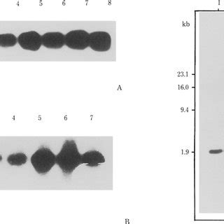 Southern Blot Hybridization Of Dna Isolated From Groundnut Transgenic