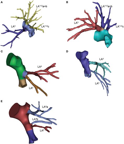 An Atlas Of Anatomical Variants Of Subsegmental Pulmonary Arteries And Recognition Error