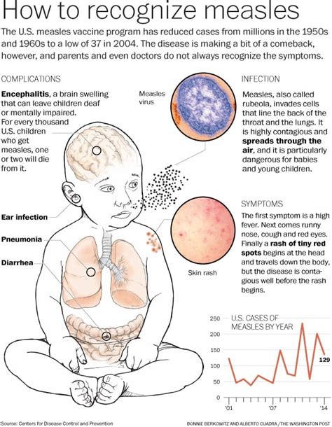 Measles Outbreak 2025 Usa - Ceil Lorene