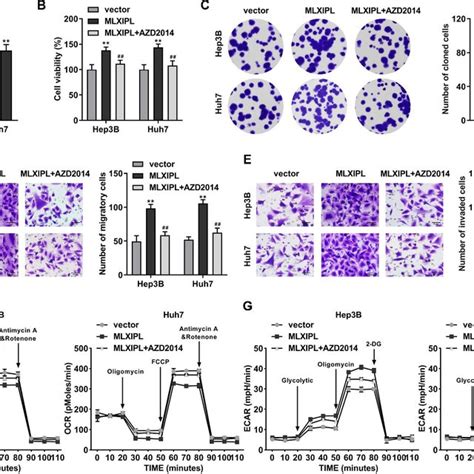 Mlxipl Overexpression Promotes Malignant Phenotypes Of Hcc Cells By