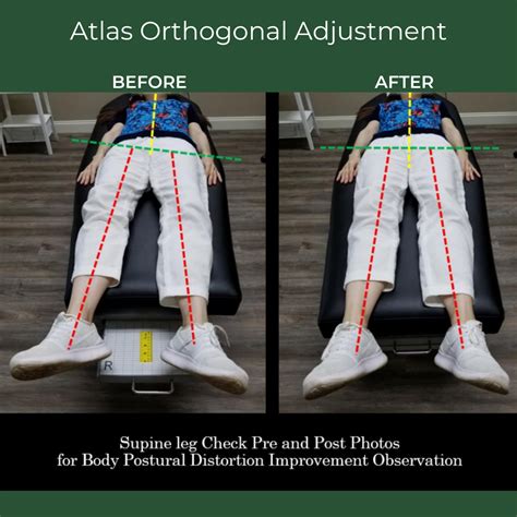 Chiropractic Adjustment Before And After