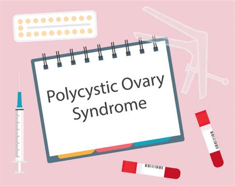 220 Polycystic Ovary Syndrome Pcos Stock Illustrations Royalty Free