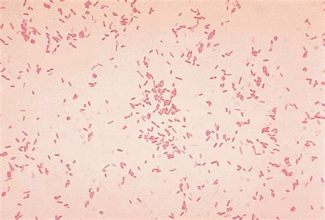 Proteus Mirabilis Disease