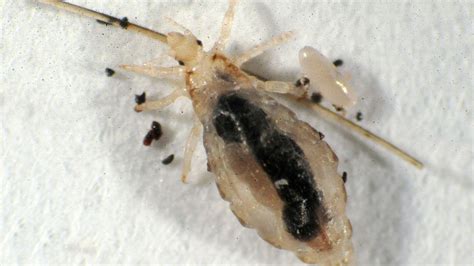 Got Lice? Stay in School