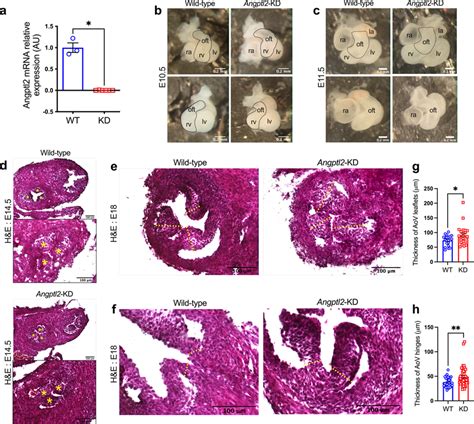 Angptl Kd Mice Exhibit Aov Defects At Embryonic Stage Aangptl Gene