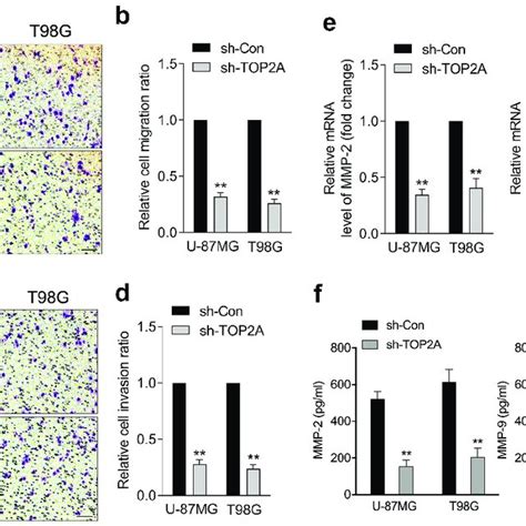 Silencing Of TOP2A Inhibits Glioma Cell Migration And Invasion In