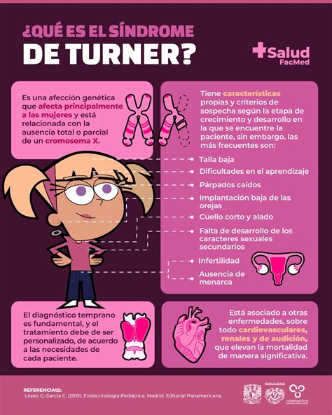 Qu Es El S Ndrome De Turner Salud Facmed