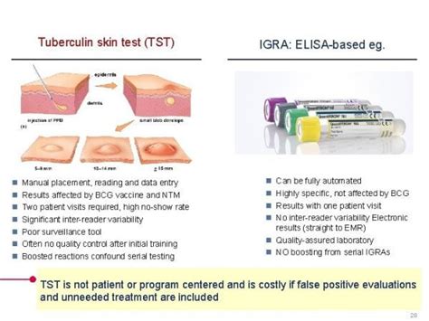 Tuberculin Skin Test Tst Uji Mantoux Tes Igra Interferon Gamma Release