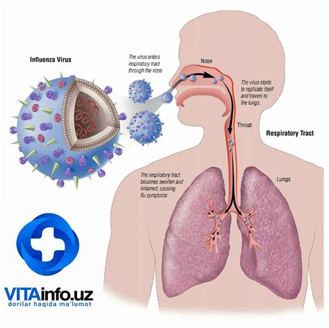 Грипп (Grippus Influenza) ⋆ WWW.SAVOL-JAVOB.COM