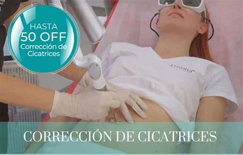 Tratamientos Laser Landing Splendor Medicina Regenerativa