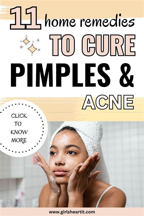 How To Get Rid Of Pimples Overnight 10 Home Remedies For Pimples Artofit