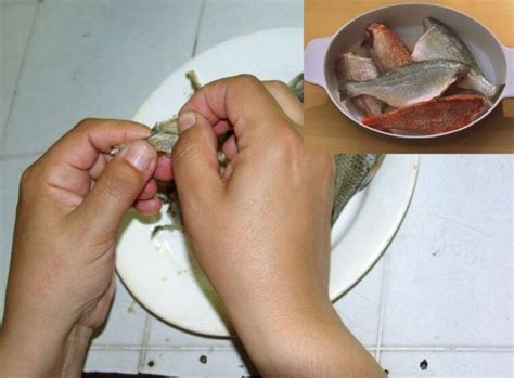 Woman Loses All Four Limbs After Eating Undercooked Fish Video