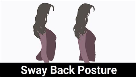 How To Fix Sway Back Posture Postures Sway Back Posture Exercises