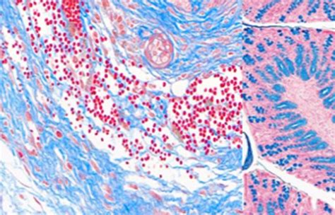 Alkaline Phosphatase Staining Protocol Of Cells Creative Bioarray