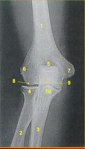 Imaging Elbow Forearm Wrist Hand Flashcards Quizlet