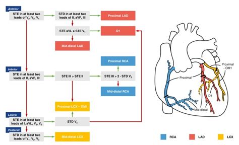 On Twitter Identifying Culprit Artery