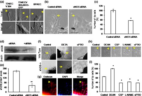 Enos Promotes Tip Cell Formation A Tip Cells Were Fixed Using 2 Download Scientific Diagram