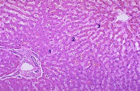 Hepatic Pathology