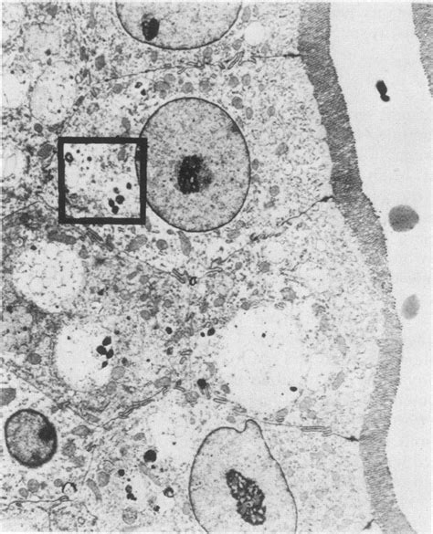 Transmission Electron Micrograph Of Ultrathin Section Through The