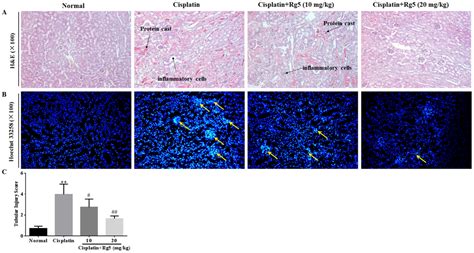 Nutrients Free Full Text Ginsenoside Rg5 Ameliorates Cisplatin