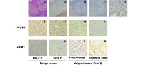 Hematoxylin Eosin Staining And Immunohistochemical Analysis Of