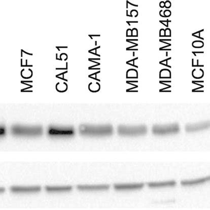 Bcl XL Protein Levels In Human Breast Epithelial Cell Lines Western