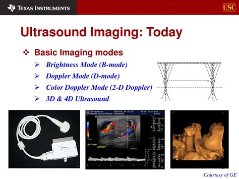 Ppt Ultrasound Imaging Powerpoint Presentation Free Download Id