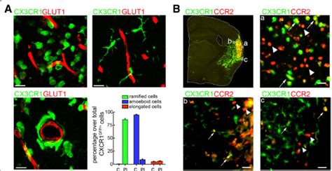 Morphological Diversity Of CX3CR1 GFP And CCR2 RFP Infiltrating