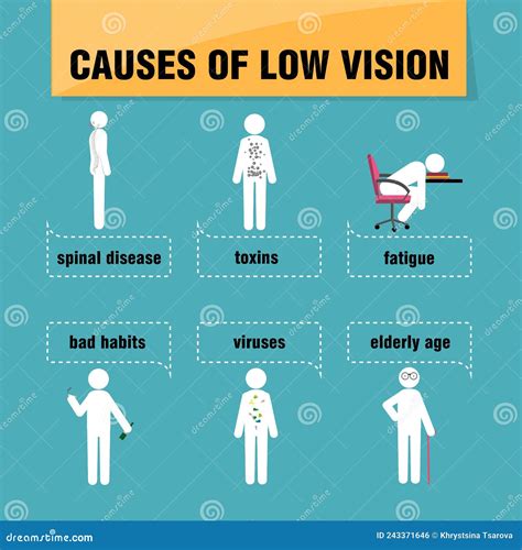 Causes of low vision. stock vector. Illustration of guide - 243371646