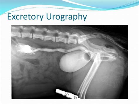 Excretory Urography