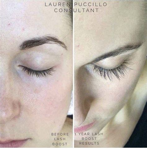 So How Does Lash Boost Work🤔 The Science Behind Iteyelashes Have A