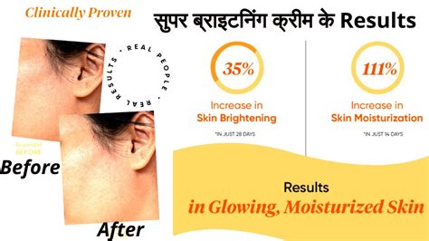 Skin Whitening Honest Unsponsored Dot Key