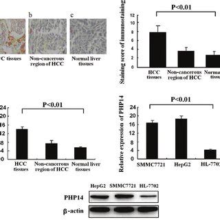 Immunohistochemistry, western blot analysis and RT-PCR analysis of ... 