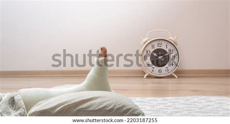 Broken Ankle Leg Cast Leg Splint Stock Photo 2203187255 Shutterstock