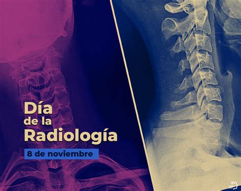 Saber IMSS on Twitter Hoy celebramos el DíadelRadiólogo en