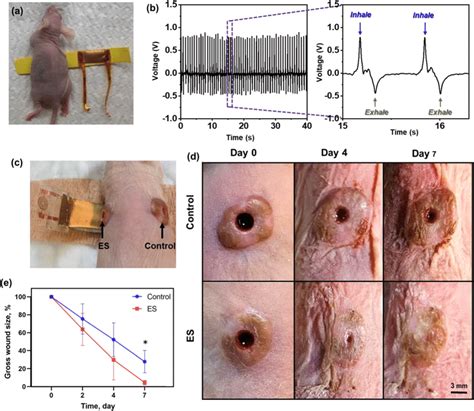 NG ES Accelerated Wound Healing In Human Skin Xenografts On Mice A A