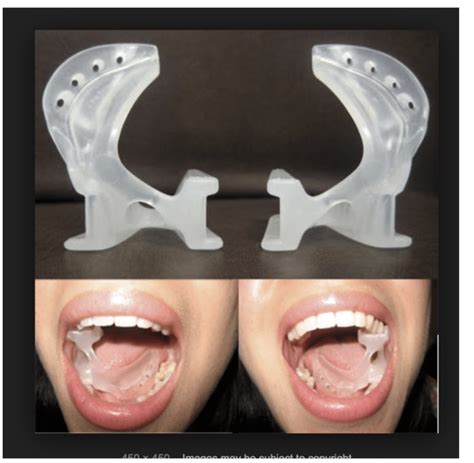 Dental Bite Blocks Wherecanibuythis