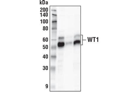 Wt1 Transcription Factor Antibodies