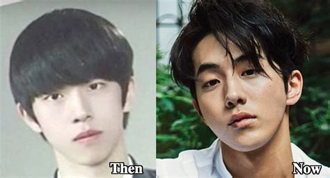 Nam Joo Hyuk Plastic Surgery Before And After Photos Latest Plastic